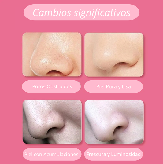 Removedor de puntos negros.